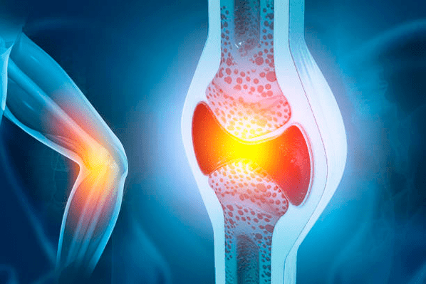 Liigesehaiguste ennetamine